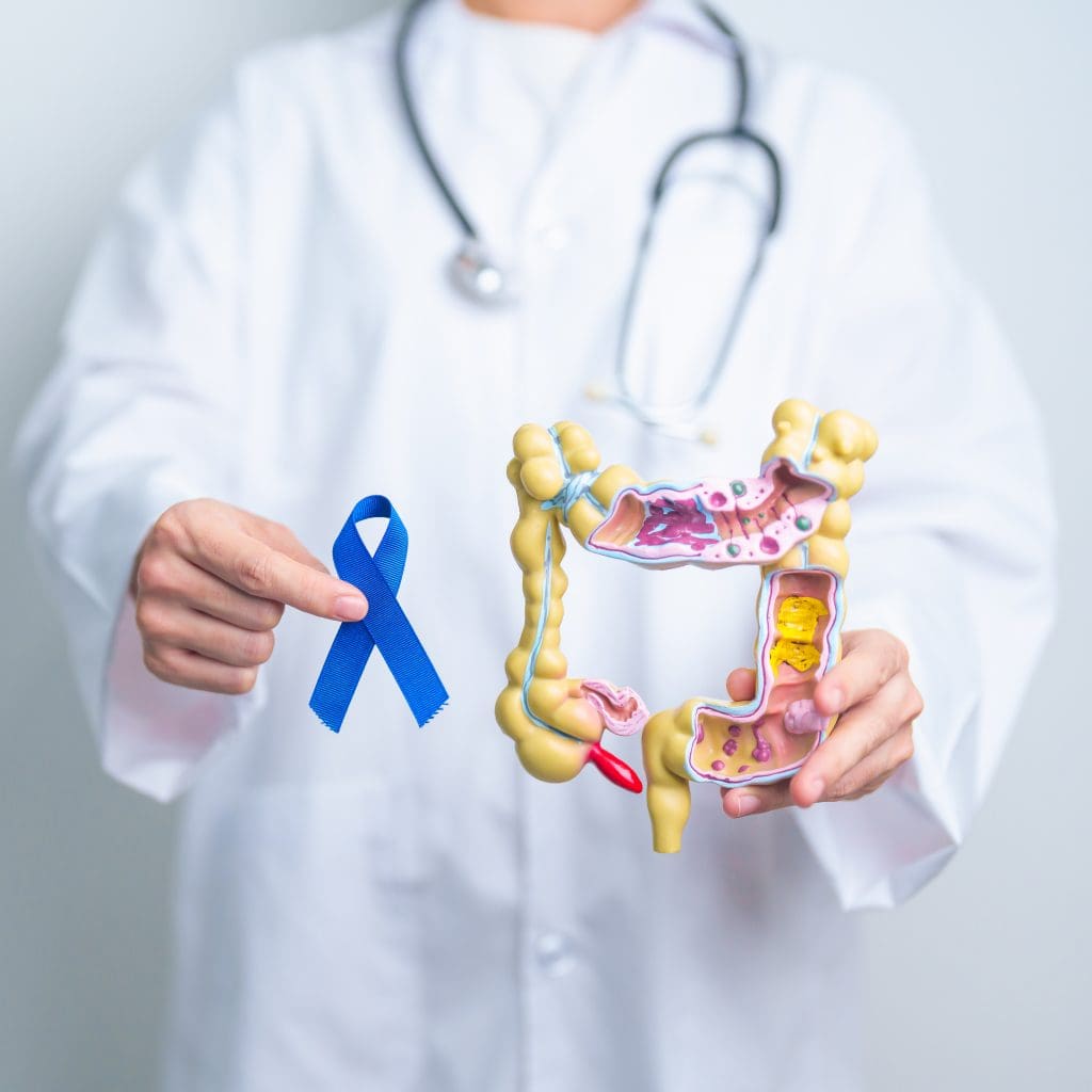 Does Colon Cancer Hurt?Â 