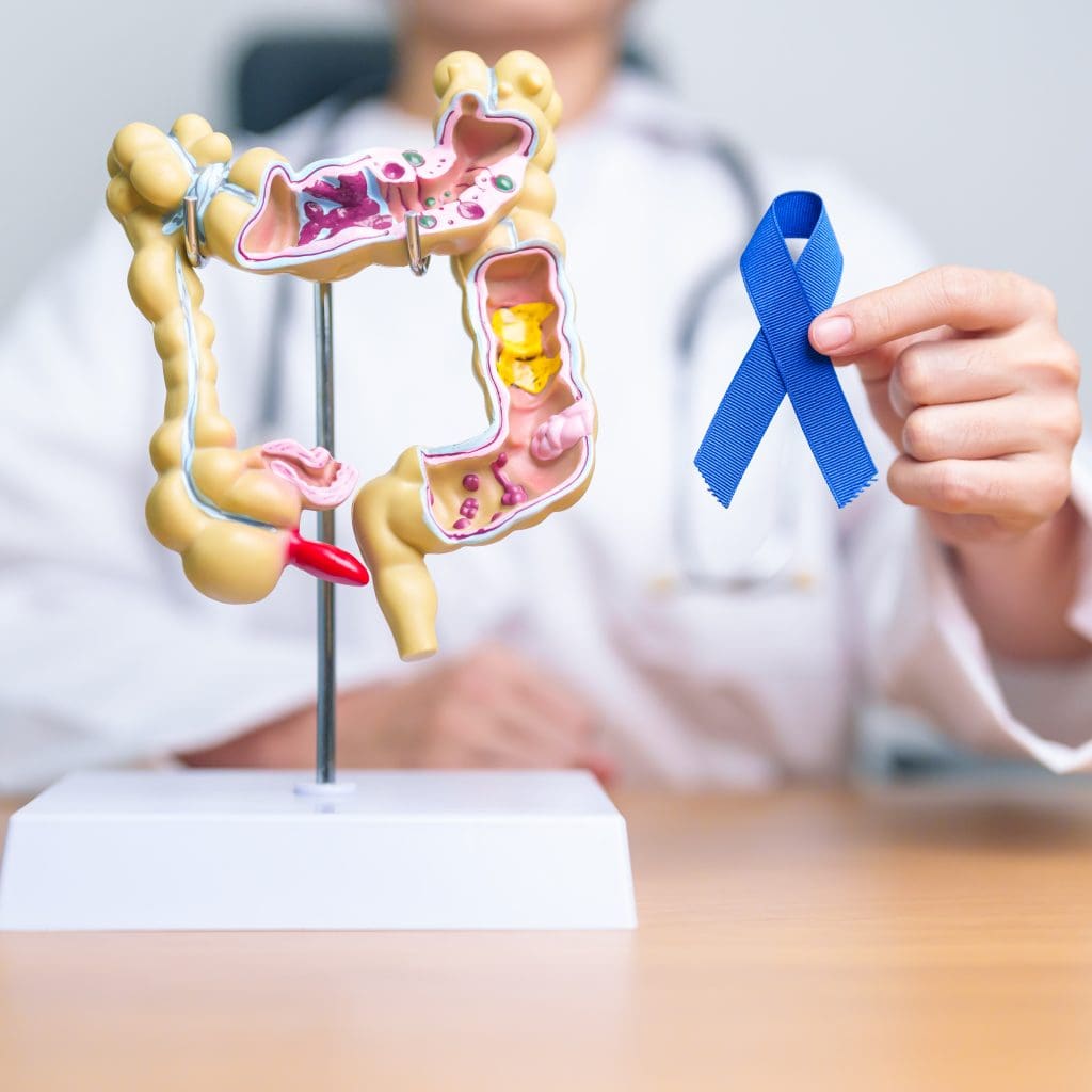 Does Colon Cancer Hurt?