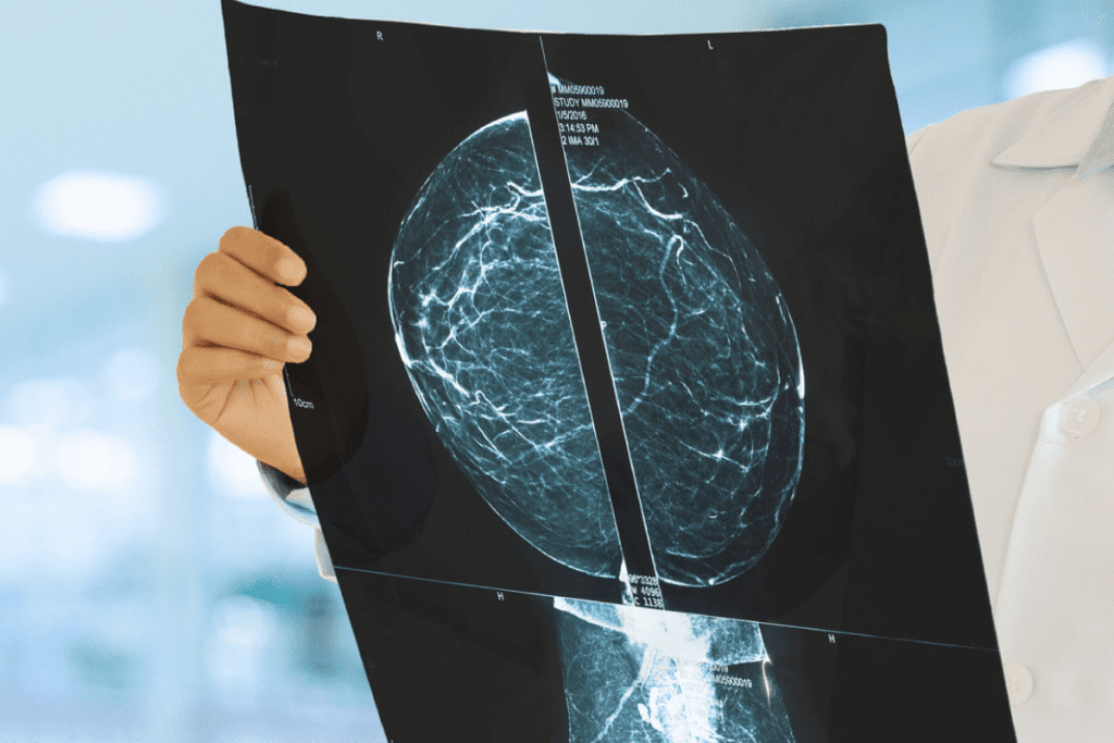 new cancer treatment that melts tumors