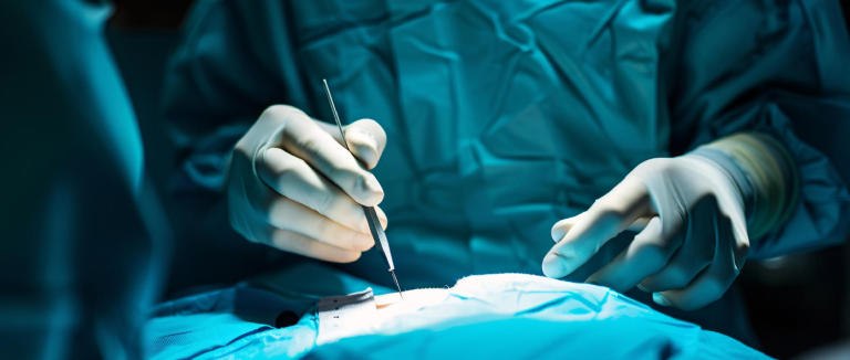 TARE (Transarterial Radioembolization)