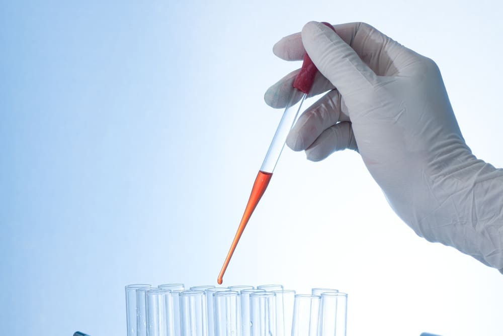 autologous stem cell transplantation