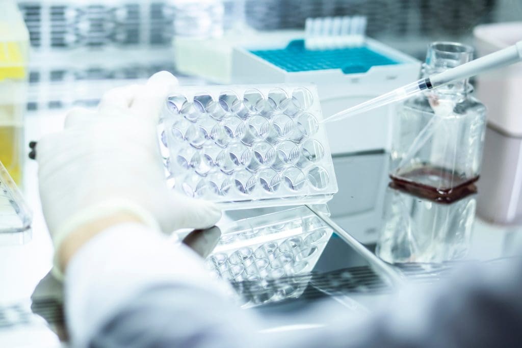 Risks of Allogeneic Stem Cell Transplant