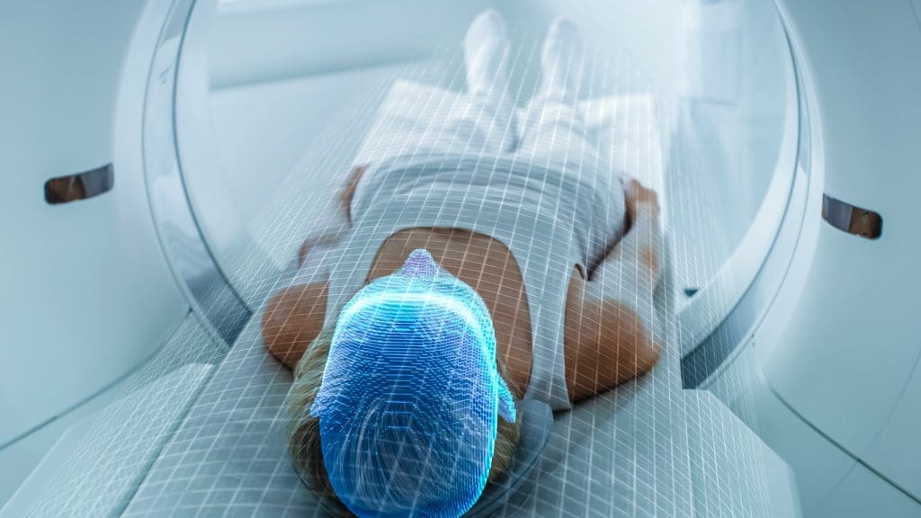 How Many Minutes Does a PET Scan Take