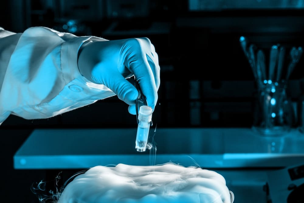 stem cell extraction