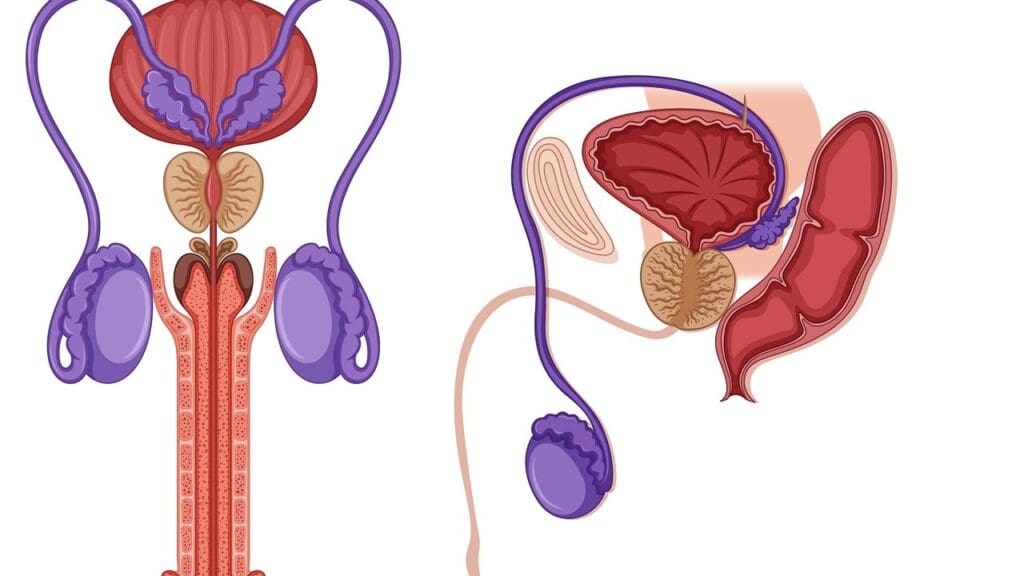7 Effective Treatments for Prostate Cancer Recurrence After Prostate Removal