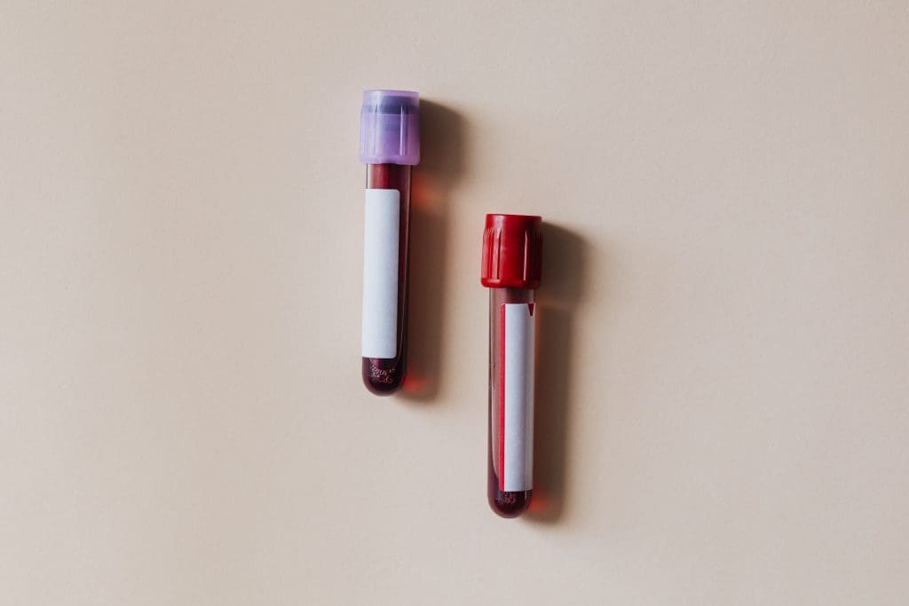 worst symptoms of low iron