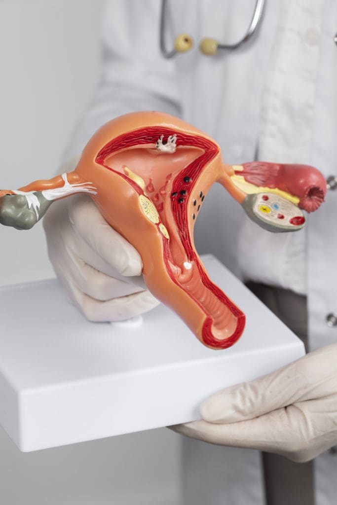 biggest cause of ovarian cancer