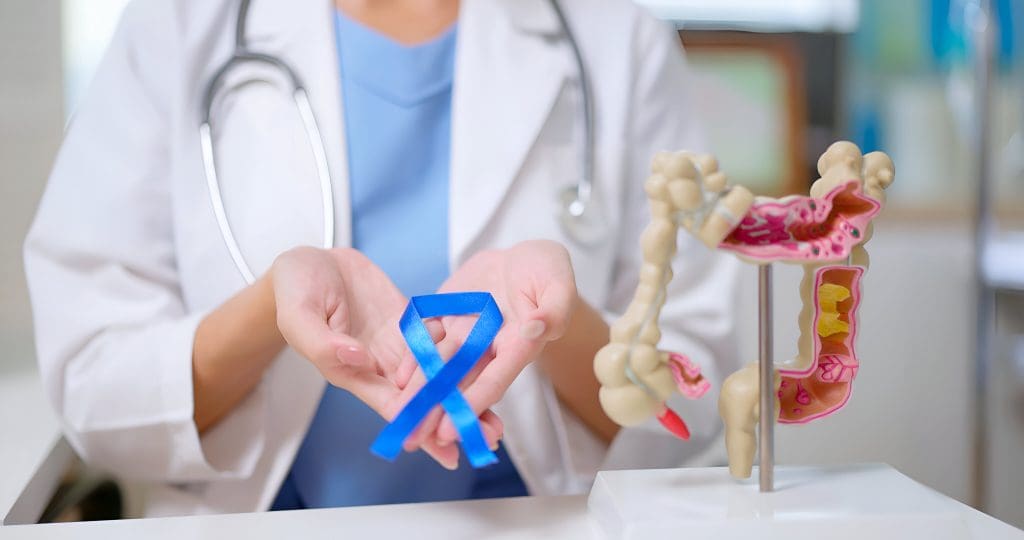 How do you avoid colon cancer